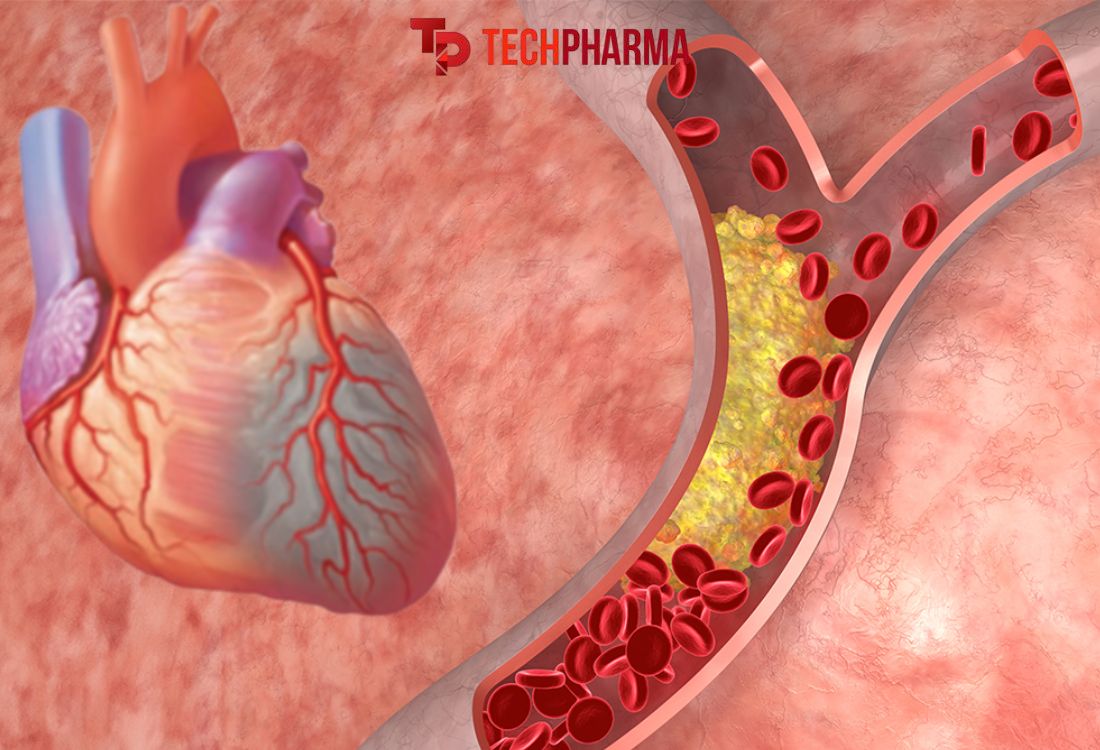 Thực phẩm giảm Cholesterol xấu