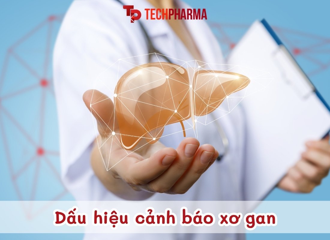 Dấu hiệu cảnh báo xơ gan